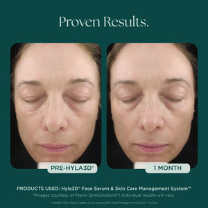 Hyla3D Face Serum