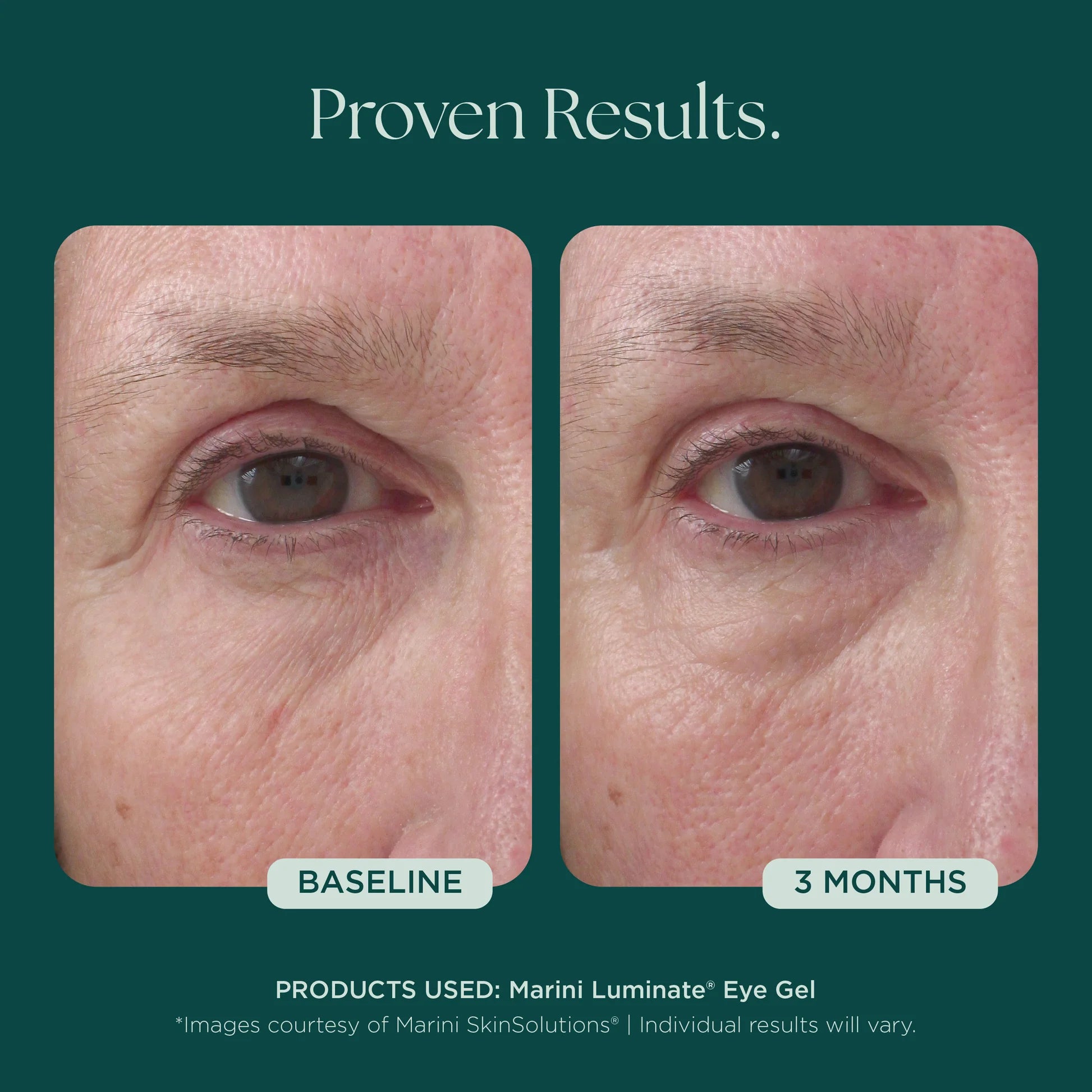 Marini Luminate Eye Gel
