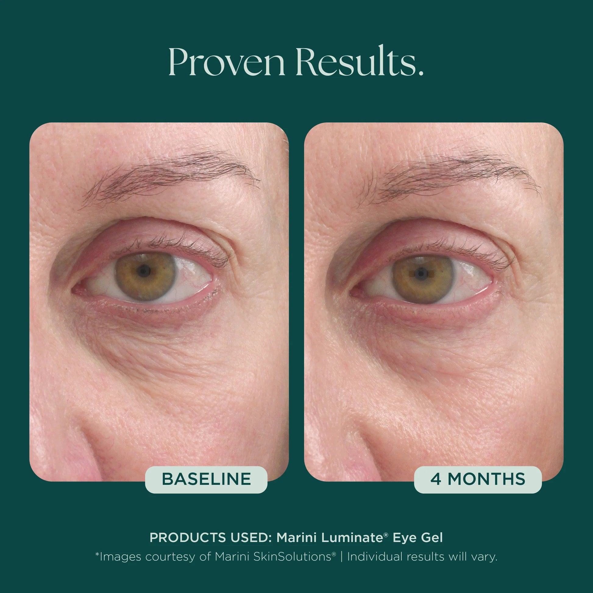 Marini Luminate Eye Gel