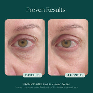 Marini Luminate gel pour les yeux
