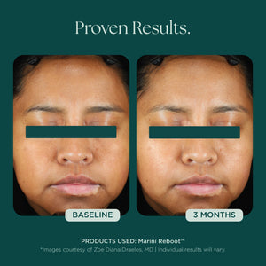 Marini Reboot Face Serum