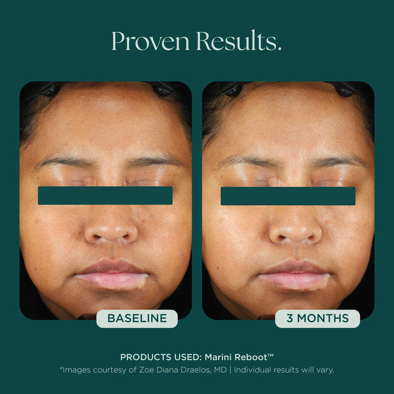 Marini Reboot Face Serum