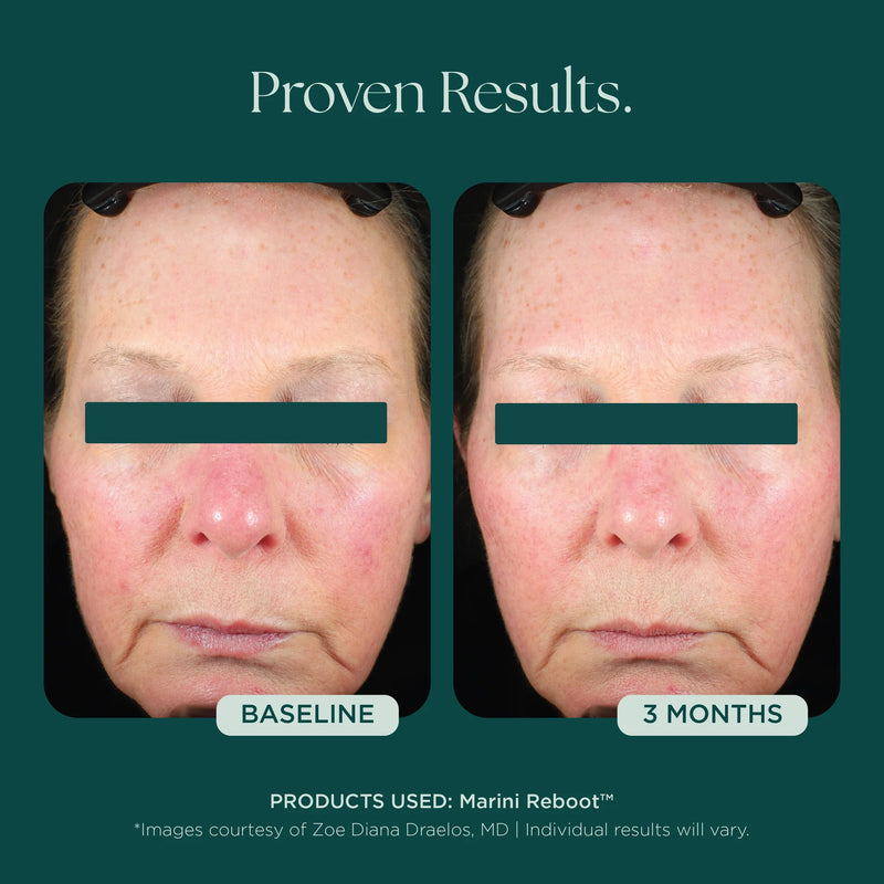 Marini Reboot Face Serum