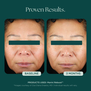 Marini Reboot Face Serum