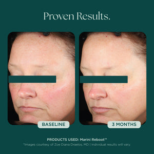 Marini Reboot Face Serum