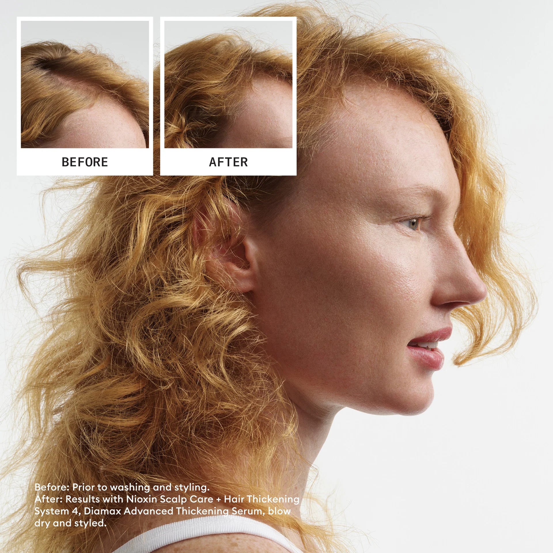 Scalp + Hair Thickening System 4