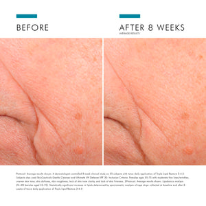 Triple Lipid Restore 2:4:2