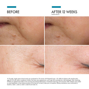 P-TIOX Anti-Wrinkle Serum