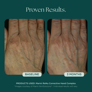 ReNu complexe correcteur pour les mains 