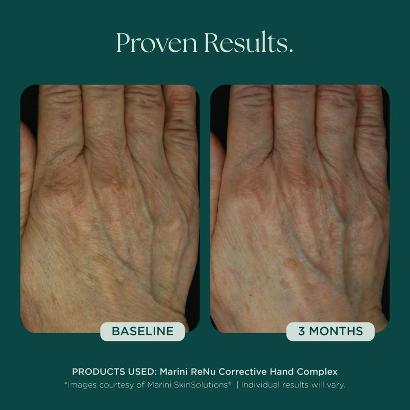 ReNu complexe correcteur pour les mains 