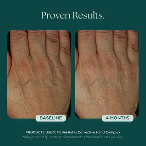ReNu complexe correcteur pour les mains 