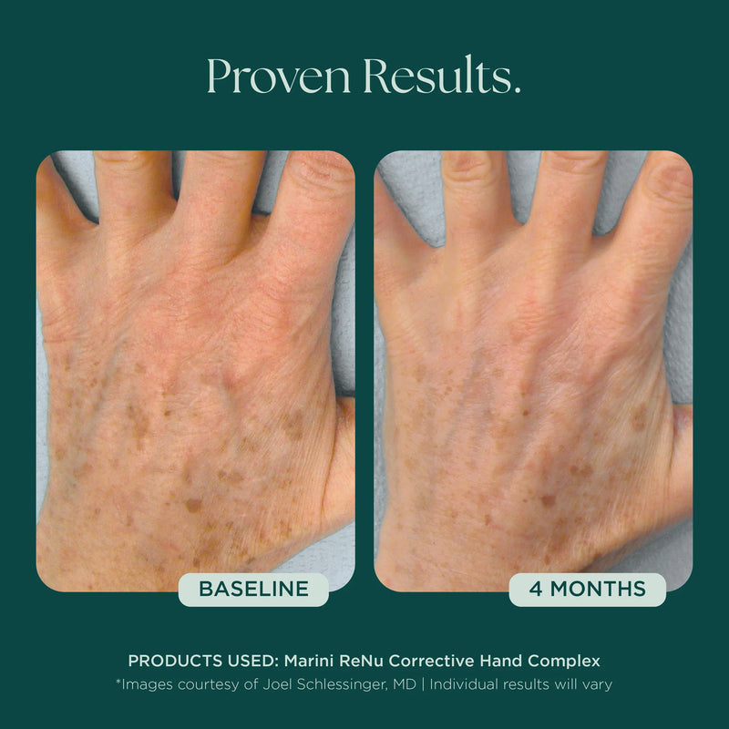 ReNu complexe correcteur pour les mains 