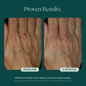 ReNu complexe correcteur pour les mains 