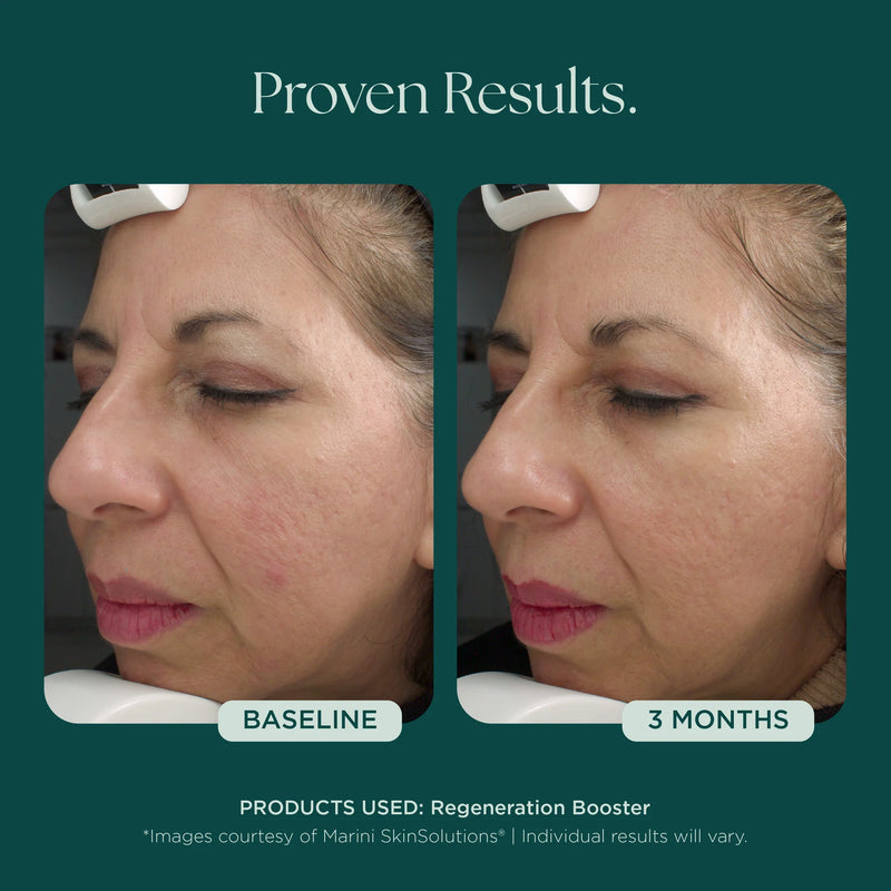 Booster de régénération
