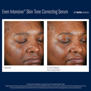 Even Intensive Sérum correcteur de teint