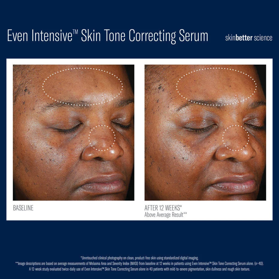 Even Intensive Skin Tone Correcting Serum