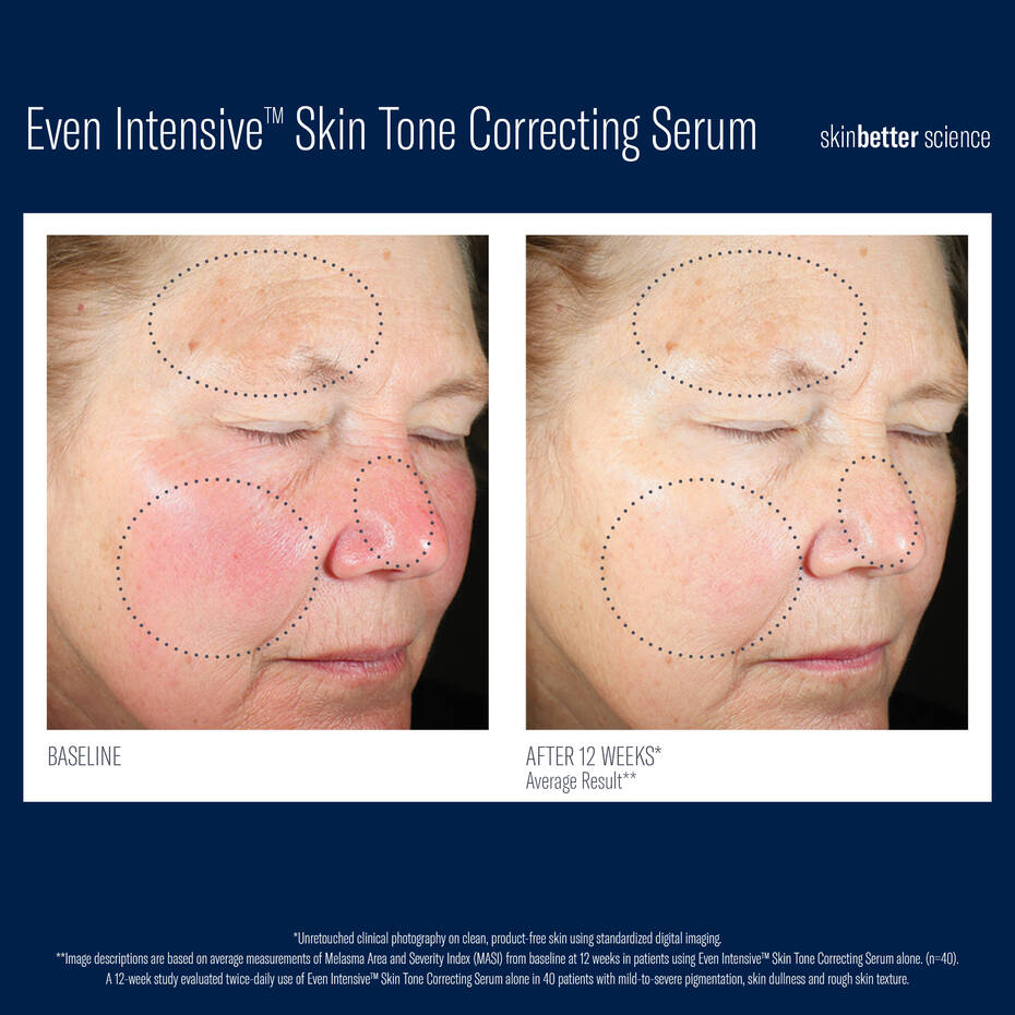 Even Intensive Skin Tone Correcting Serum