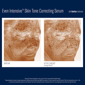 Even Intensive Sérum correcteur de teint