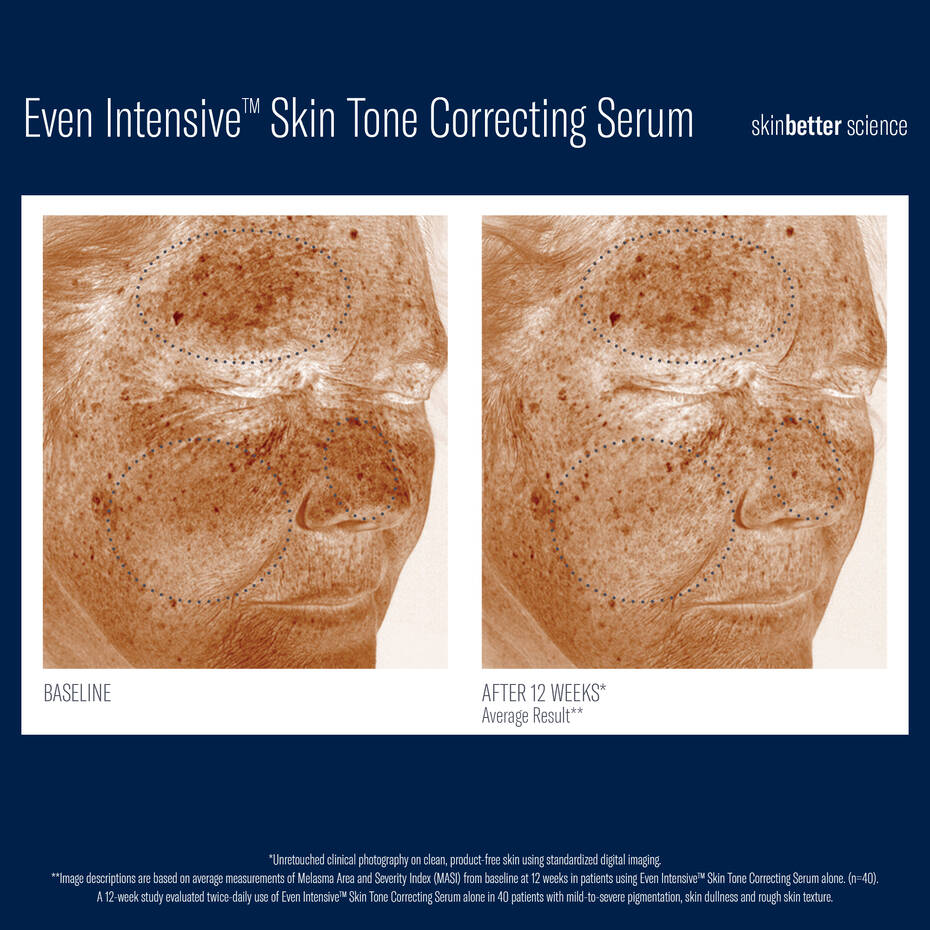 Even Intensive Skin Tone Correcting Serum