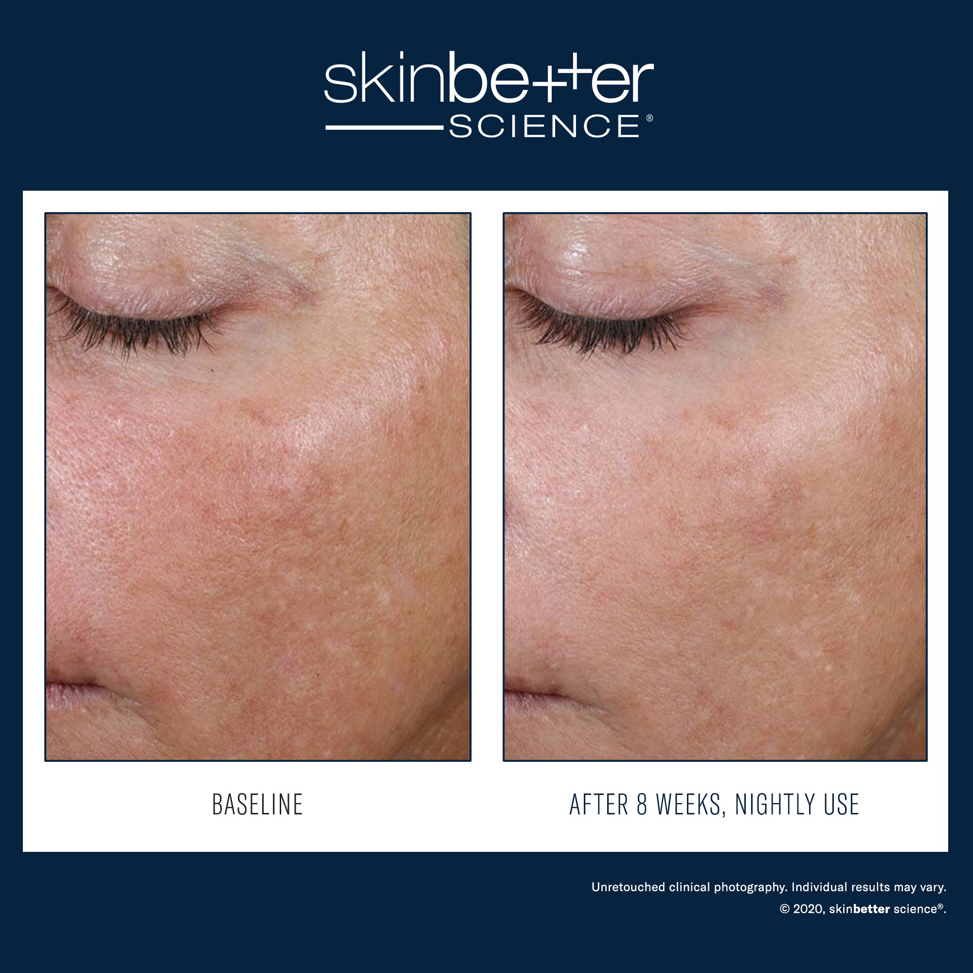 SkinBetter Science - AlphaRet Overnight Cream – Boutique Skin Envie