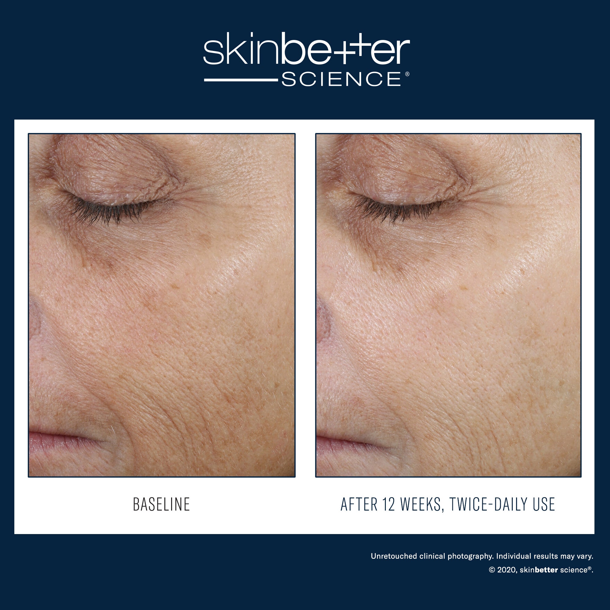 SkinBetter Science - Even Tone Correcting Serum Face – Boutique Skin Envie