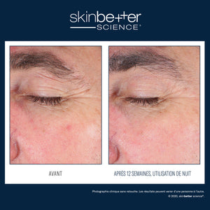 EyeMax AlphaRet Overnight Cream