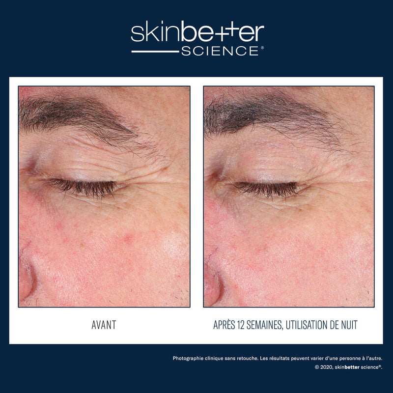 EyeMax AlphaRet Overnight Cream
