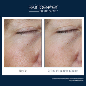 Instant Effect Gel Eye