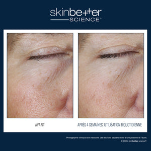 Instant Effect Gel Eye