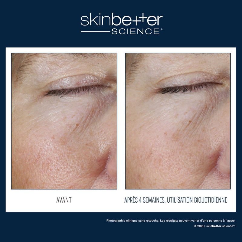 Instant Effect Gel Eye