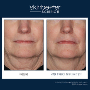 Traitement Interfuse Crème pour le visage et le cou