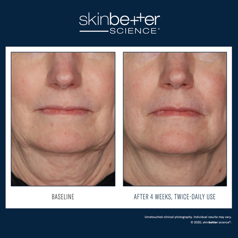 Traitement Interfuse Crème pour le visage et le cou