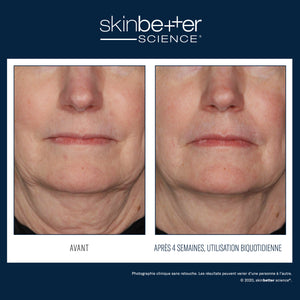 Traitement Interfuse Crème pour le visage et le cou