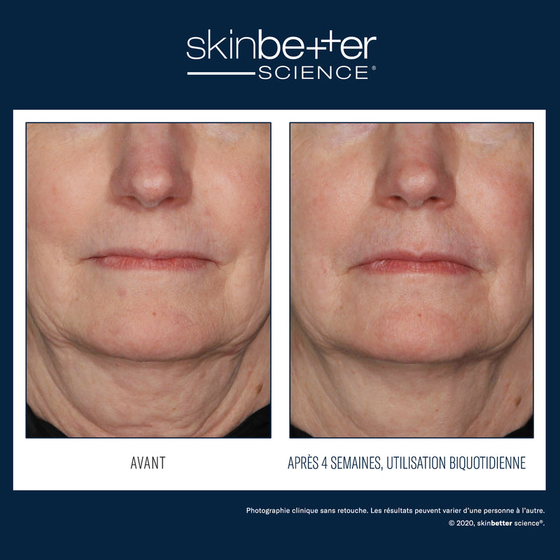 Traitement Interfuse Crème pour le visage et le cou