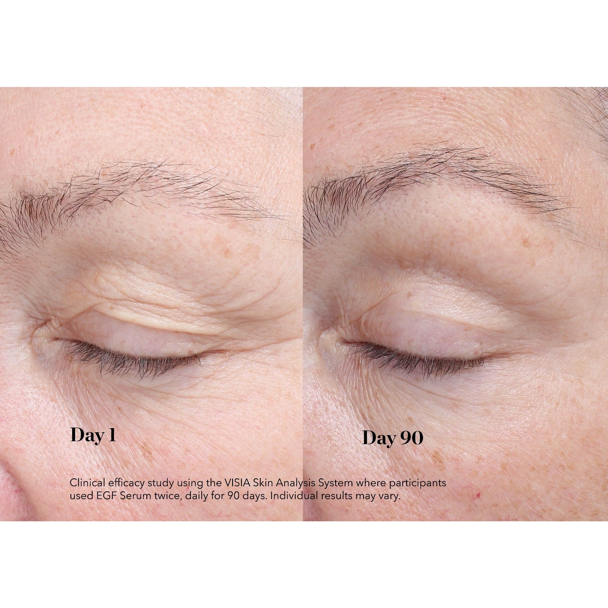 EGF Serum