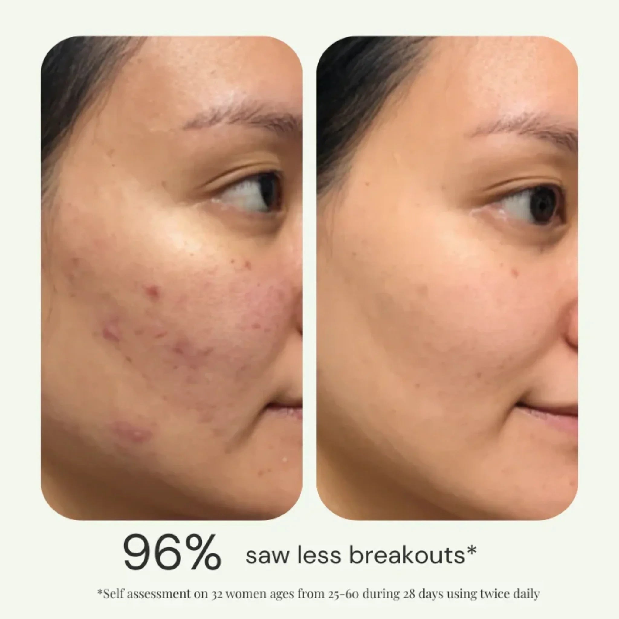 Perfect10 Moisturizer Primer Serum