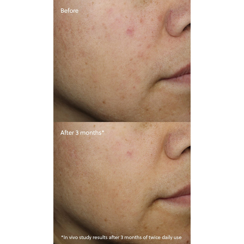eminence-organic-skin-care-vitamin-c-serum-6
