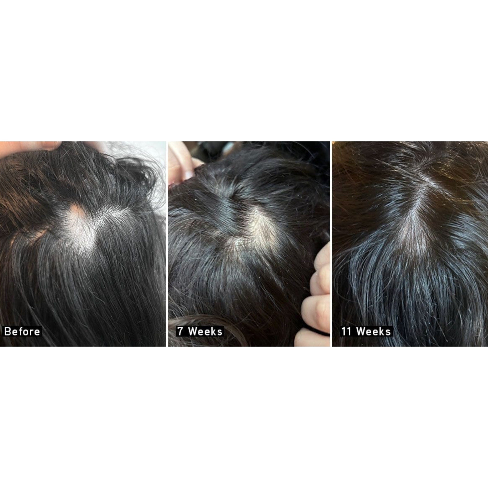 Scalp + Hair Rejuvenating Booster