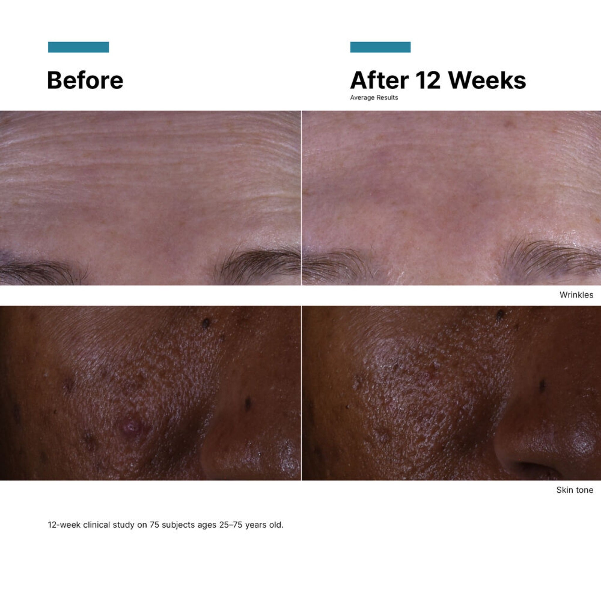 C E Ferulic
