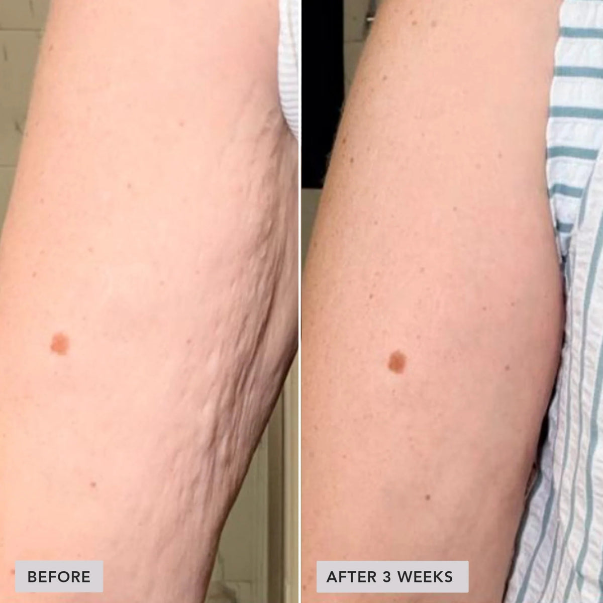 image-skin-care-vol-u-lift-body-glp-1-gip-sculpt-firm-treatment-complex-3