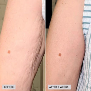 image-skin-care-vol-u-lift-body-glp-1-gip-sculpt-firm-treatment-complex-3