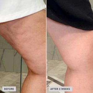 image-skin-care-vol-u-lift-body-glp-1-gip-sculpt-firm-treatment-complex-4