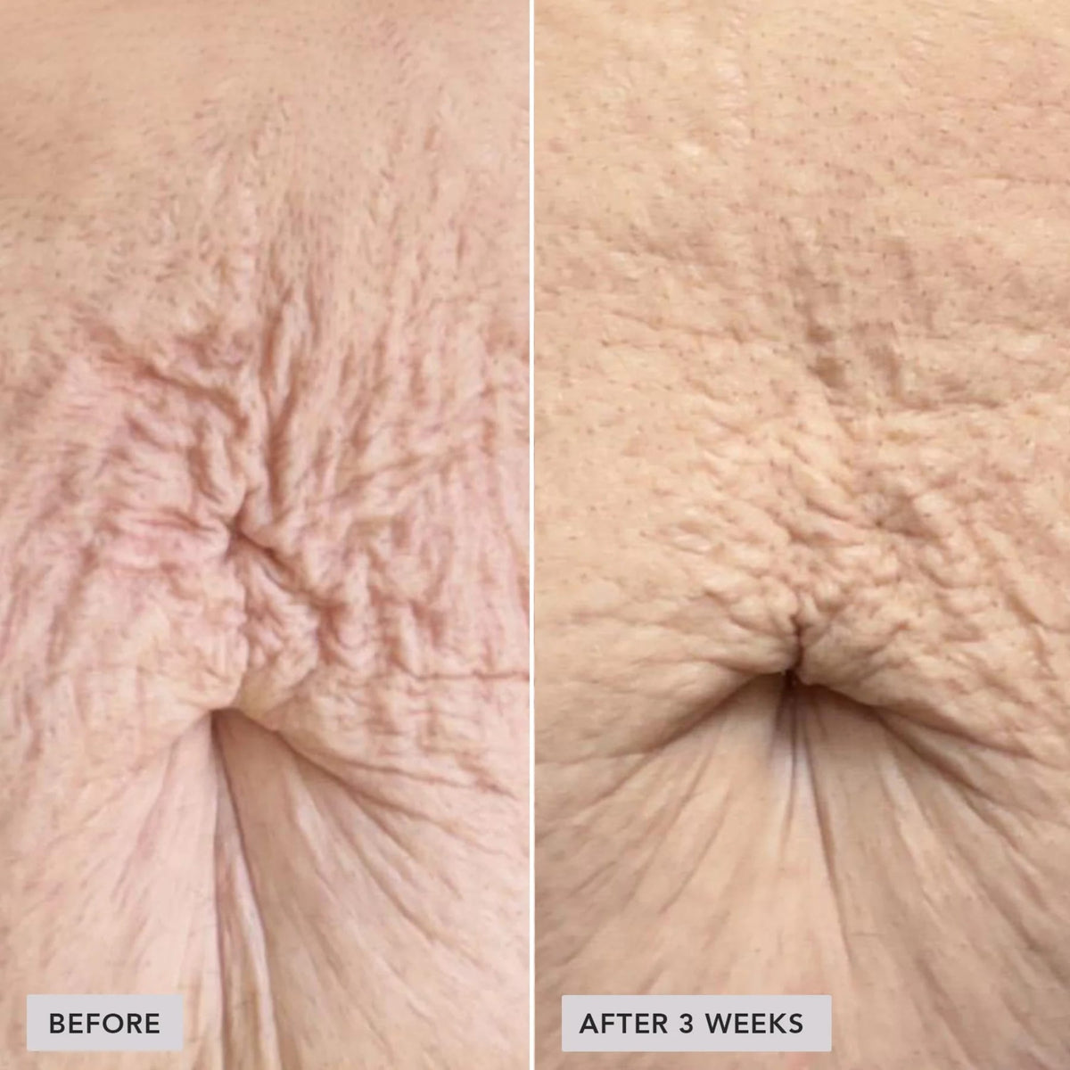 image-skin-care-vol-u-lift-body-glp-1-gip-sculpt-firm-treatment-complex-5