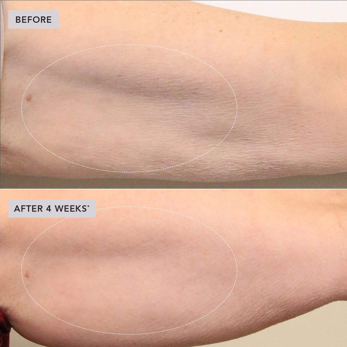 image-skin-care-vol-u-lift-body-glp-1-gip-sculpt-firm-treatment-complex-6