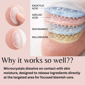 ivoryloom-microdart-spot-patch-6