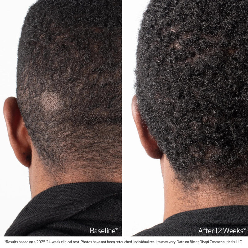 Nu-Cil BioStim™ Scalp Serum (Sérum pour le cuir chevelu Nu-Cil BioStim™)