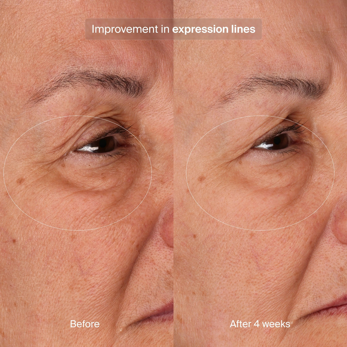 pavise-bioadaptive-stress-repair-1