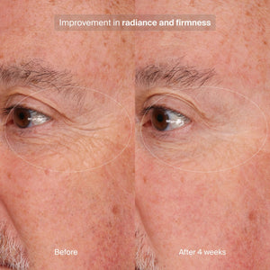 pavise-precision-eye-lift-1