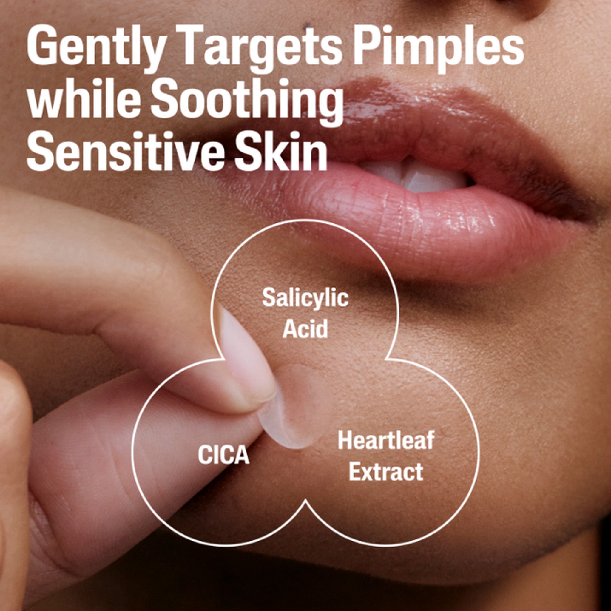 Fast Rescue Pimple Patches