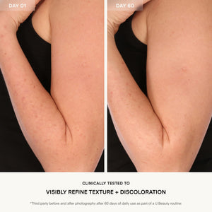 Resurfacing Body Compound